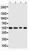 TNF Receptor Associated Factor 4 antibody, LS-C313139, Lifespan Biosciences, Western Blot image 