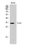 Forkhead Box E1 antibody, A02831, Boster Biological Technology, Western Blot image 
