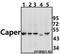 ATPase H+ Transporting Accessory Protein 2 antibody, A02665, Boster Biological Technology, Western Blot image 