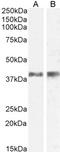 Glucosaminyl (N-Acetyl) Transferase 3, Mucin Type antibody, 46-664, ProSci, Enzyme Linked Immunosorbent Assay image 