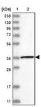 PHD Finger Protein 7 antibody, PA5-57594, Invitrogen Antibodies, Western Blot image 