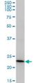 Recoverin antibody, H00005957-M37, Novus Biologicals, Western Blot image 