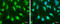Suppressor Of Cytokine Signaling 1 antibody, GTX100657, GeneTex, Immunofluorescence image 