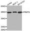 Protein Arginine Methyltransferase 8 antibody, MBS126377, MyBioSource, Western Blot image 