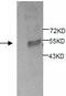 Sphingomyelin Phosphodiesterase Acid Like 3B antibody, TA310131, Origene, Western Blot image 