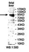 PiggyBac Transposable Element Derived 1 antibody, orb77968, Biorbyt, Western Blot image 