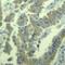 Myristoylated Alanine Rich Protein Kinase C Substrate antibody, 79-246, ProSci, Immunohistochemistry paraffin image 