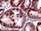 MutS Homolog 6 antibody, PA5-32509, Invitrogen Antibodies, Immunohistochemistry paraffin image 