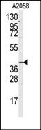 G Protein Subunit Alpha 12 antibody, AP14960PU-N, Origene, Western Blot image 