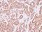 Actin Like 8 antibody, PA5-21788, Invitrogen Antibodies, Immunohistochemistry paraffin image 