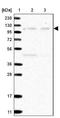 Ribophorin II antibody, NBP2-38324, Novus Biologicals, Western Blot image 