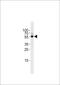 Transforming Growth Factor Beta 2 antibody, 57-975, ProSci, Western Blot image 