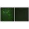 Trafficking Regulator Of GLUT4 (SLC2A4) 1 antibody, PA5-49848, Invitrogen Antibodies, Immunofluorescence image 