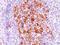TNF Receptor Superfamily Member 8 antibody, NBP2-33196, Novus Biologicals, Immunohistochemistry paraffin image 