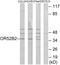 Olfactory Receptor Family 52 Subfamily B Member 2 antibody, GTX87314, GeneTex, Western Blot image 