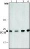 Serine And Arginine Rich Splicing Factor 2 antibody, NB100-1774, Novus Biologicals, Western Blot image 