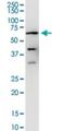 Calcineurin A antibody, H00005530-M03, Novus Biologicals, Western Blot image 