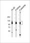 Solute Carrier Family 3 Member 2 antibody, 55-062, ProSci, Western Blot image 