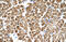 Tropomyosin 2 antibody, ARP48224_T100, Aviva Systems Biology, Immunohistochemistry frozen image 