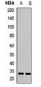 SRY-Box 14 antibody, LS-C668690, Lifespan Biosciences, Western Blot image 