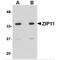 Solute Carrier Family 39 Member 11 antibody, MBS150795, MyBioSource, Western Blot image 