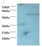 Programmed Cell Death 6 antibody, orb238259, Biorbyt, Western Blot image 