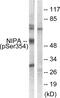 Zinc Finger C3HC-Type Containing 1 antibody, PA5-38782, Invitrogen Antibodies, Western Blot image 