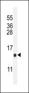 Lutropin beta chain antibody, 63-319, ProSci, Western Blot image 