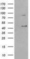 Serpin Family B Member 3 antibody, NBP2-03483, Novus Biologicals, Western Blot image 