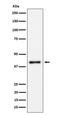 Interleukin 15 Receptor Subunit Alpha antibody, M03016-1, Boster Biological Technology, Western Blot image 