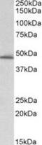 Serpin Family E Member 1 antibody, MBS420848, MyBioSource, Western Blot image 