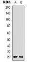 CD3d Molecule antibody, LS-C368728, Lifespan Biosciences, Western Blot image 