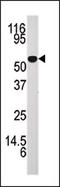 Adenosine Kinase antibody, AP13680PU-N, Origene, Western Blot image 