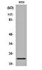 Calcineurin Like EF-Hand Protein 2 antibody, orb160437, Biorbyt, Western Blot image 