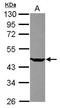 Lysine Methyltransferase 5A antibody, GTX119440, GeneTex, Western Blot image 