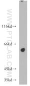 TBC1 Domain Family Member 22A antibody, 18332-1-AP, Proteintech Group, Western Blot image 