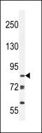 Lysine Demethylase 3B antibody, LS-C165359, Lifespan Biosciences, Western Blot image 