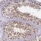 Karyopherin Subunit Alpha 3 antibody, NBP2-38541, Novus Biologicals, Immunohistochemistry paraffin image 