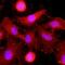 C-Type Lectin Domain Family 4 Member E antibody, ab100846, Abcam, Immunofluorescence image 