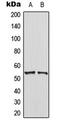 Phosphatase And Tensin Homolog antibody, LS-C354073, Lifespan Biosciences, Western Blot image 