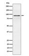 Ribosomal Protein S6 Kinase A1 antibody, M01058-2, Boster Biological Technology, Western Blot image 