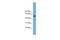 TRNA Methyltransferase 13 Homolog antibody, A14280, Boster Biological Technology, Western Blot image 
