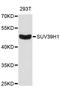 Suppressor Of Variegation 3-9 Homolog 1 antibody, STJ111137, St John