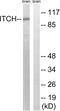 Itchy E3 Ubiquitin Protein Ligase antibody, abx012956, Abbexa, Western Blot image 
