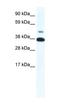 Thyroid Hormone Receptor Beta antibody, orb329841, Biorbyt, Western Blot image 