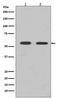 FYN Proto-Oncogene, Src Family Tyrosine Kinase antibody, M00684, Boster Biological Technology, Western Blot image 