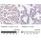 Transmembrane Protein 38A antibody, NBP2-13452, Novus Biologicals, Immunohistochemistry paraffin image 