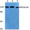 Protein Phosphatase 1 Regulatory Subunit 13B antibody, A07257-1, Boster Biological Technology, Western Blot image 