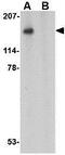 SLIT And NTRK Like Family Member 5 antibody, GTX85414, GeneTex, Western Blot image 