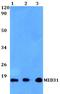 Mediator Complex Subunit 31 antibody, A08877, Boster Biological Technology, Western Blot image 